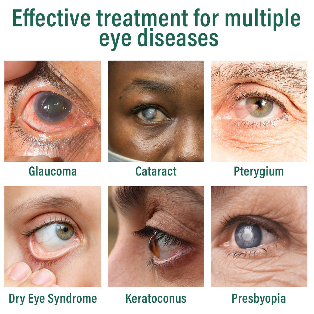 ✅ Ourlyard® Nano Eye Drops Serum 👩⚕️MHRA-approved (Suitable for presbyopia, dry eye syndrome, glaucoma, and cataracts) up