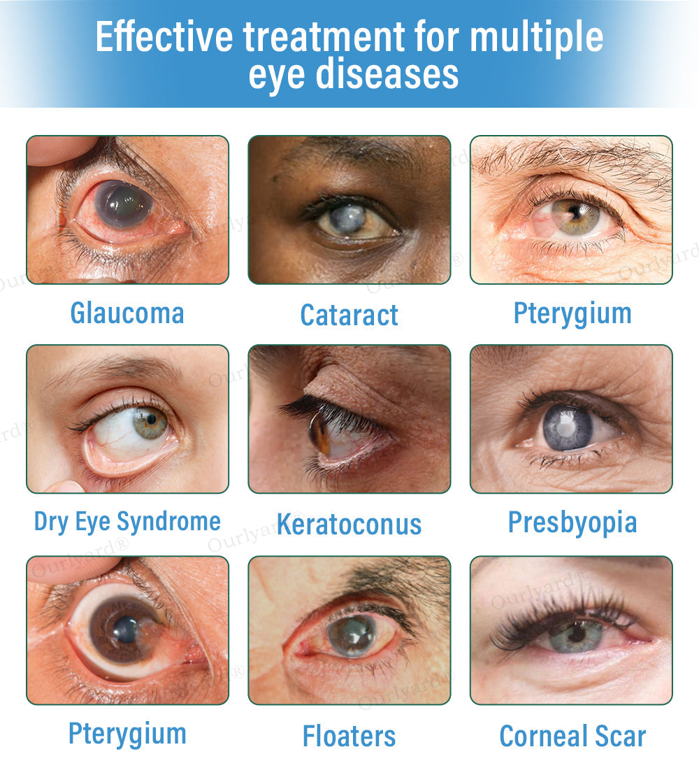 👩⚕️Ourlyard® Supramolecular Eye Drops ✅MHRA approved (Suitable for cataracts, floaters, AMD and presbyopia) 🌵