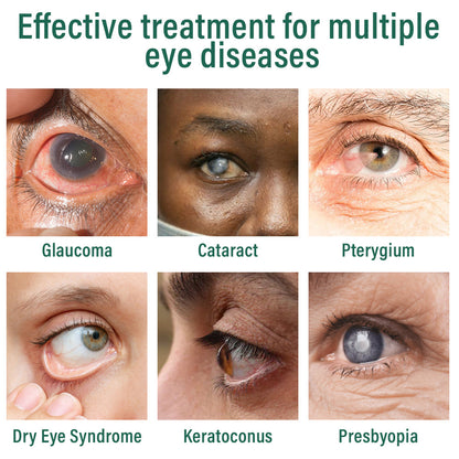 ✅ Ourlyard® Nano Eye Drops Serum 👩‍⚕️MHRA-approved (Suitable for presbyopia, dry eye syndrome, glaucoma, and cataracts) up