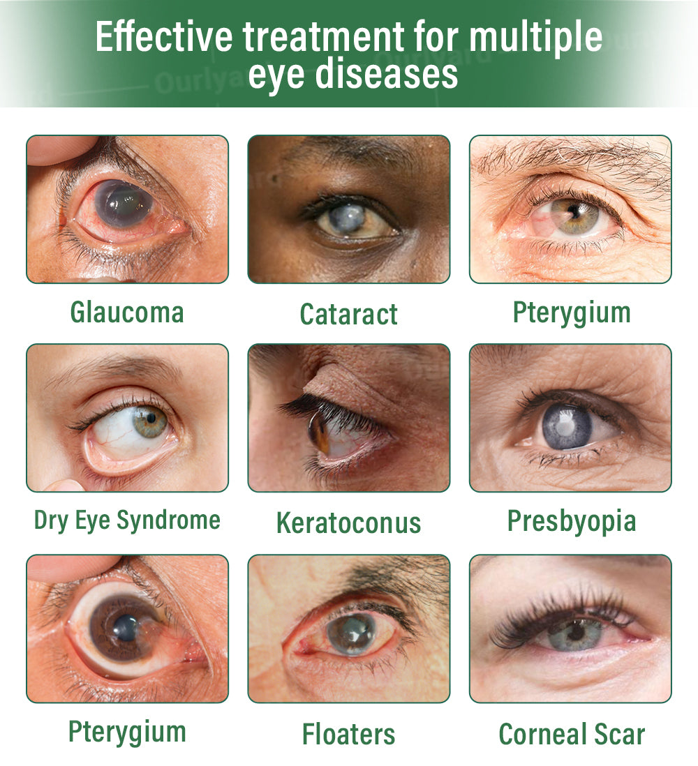 👨🏻‍⚕️Ourlyard® OptiClear DualTech Eye Drops ✅️ MHRA approved | Supports Presbyopia, Dry Eyes, Glaucoma & Cataracts 🍀