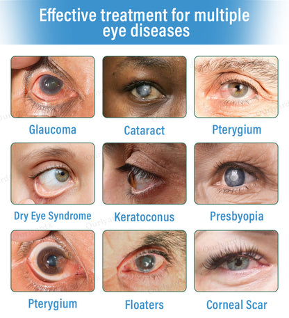 👩‍⚕️Ourlyard® Supramolecular Eye Drops ✅MHRA approved (Suitable for cataracts, floaters, AMD and presbyopia) 🌵 (Copy)